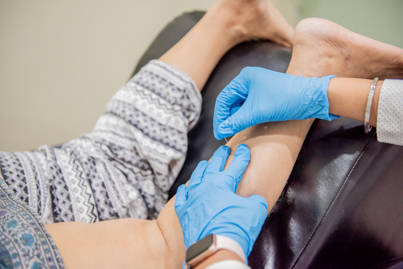 Dry Needling